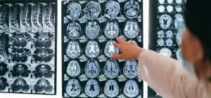 self-esteem and the brain