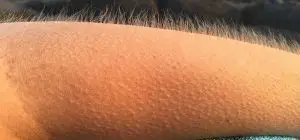 Physiological responses